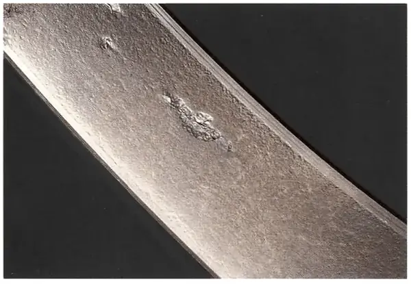 Severe bruising can progress into spalling.